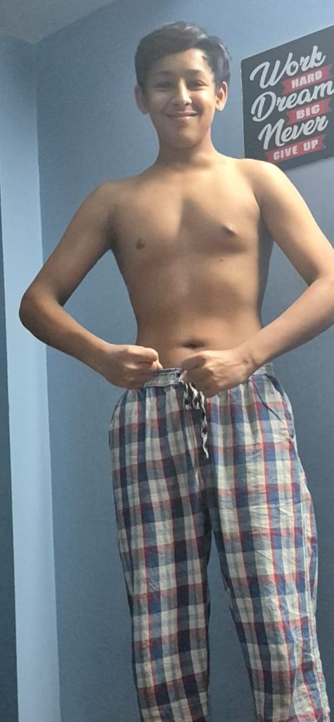 Dhruv Bora transformation — after