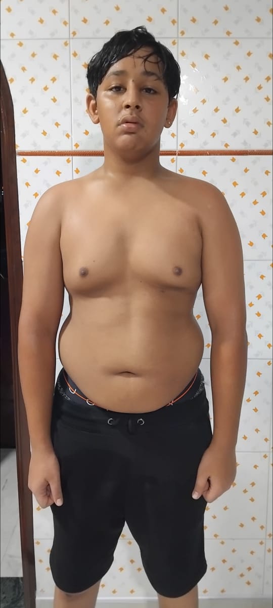 Dhruv Bora transformation — before