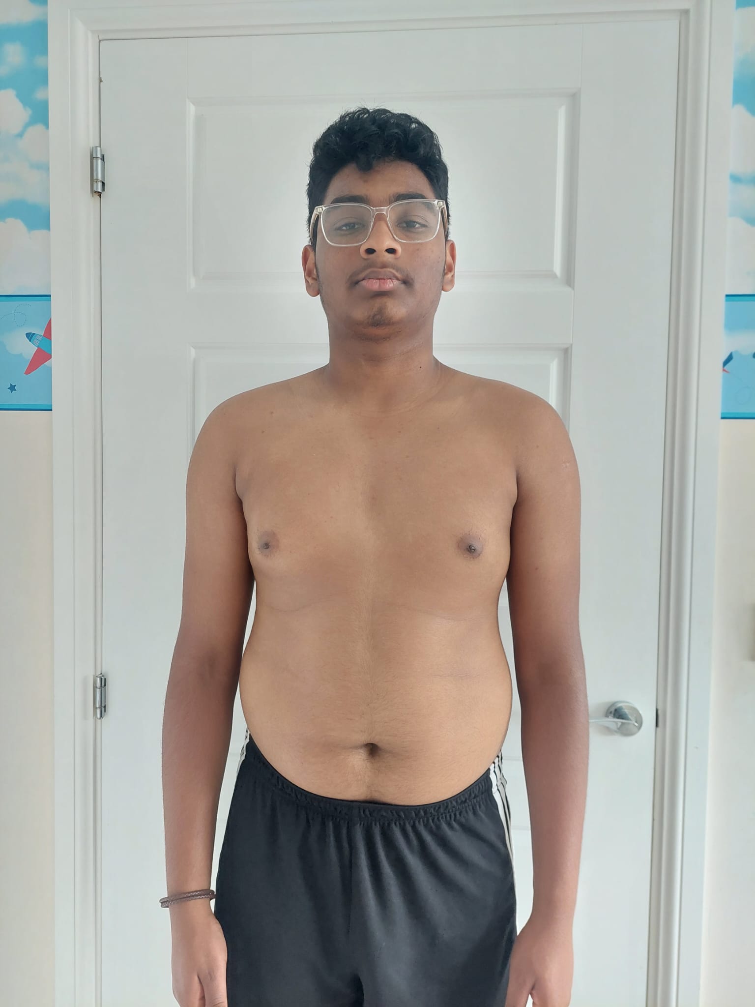 Dharshan transformation — before